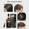 Pei Mei Hair Growth Serum, with Biotin & DHT Blocker, for Hair Loss Prevention