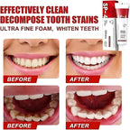 Ultra Whitening Toothpaste, Natural Stain Removal & Fresh Breath, for Daily Oral Care