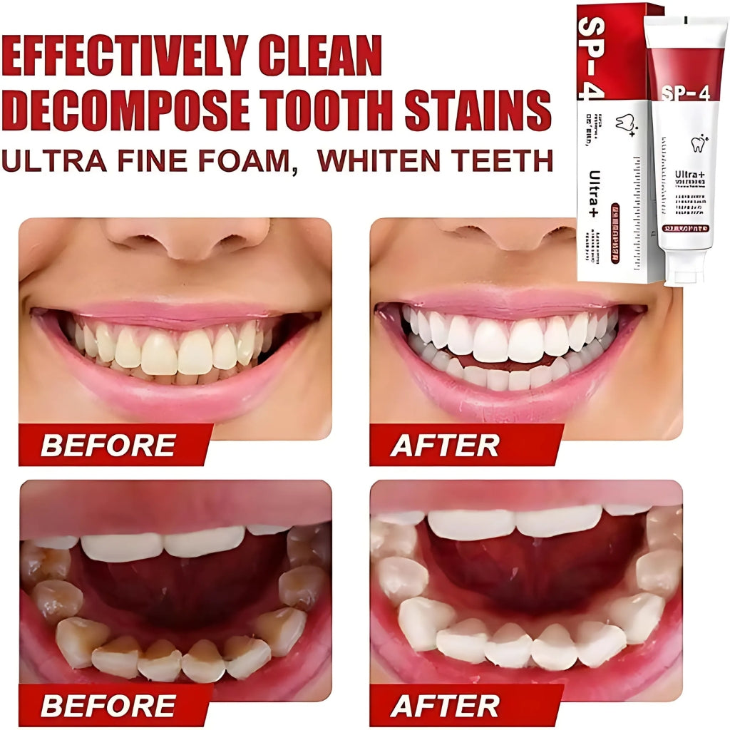 Ultra Whitening Toothpaste, Natural Stain Removal & Fresh Breath, for Daily Oral Care