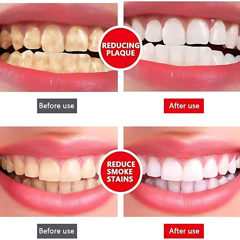 Ultra Whitening Toothpaste, Natural Stain Removal & Fresh Breath, for Daily Oral Care