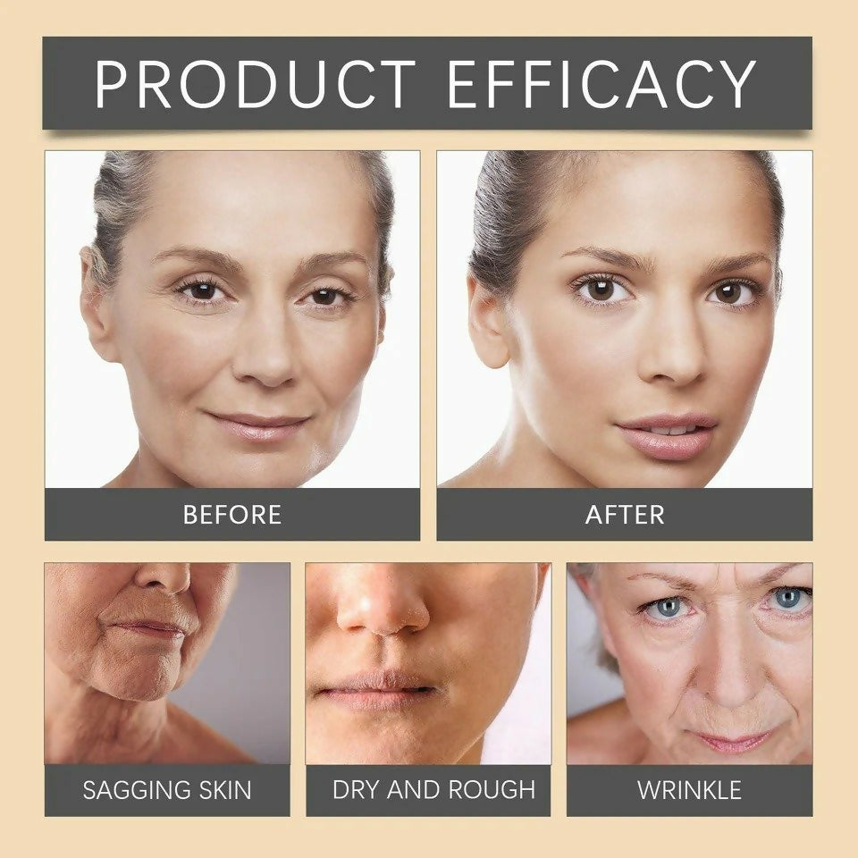 Botox Bee Venom Whitening & Moisturizing Cream – Anti-Aging, Brightening & Skin Firming Facial Care (20g)