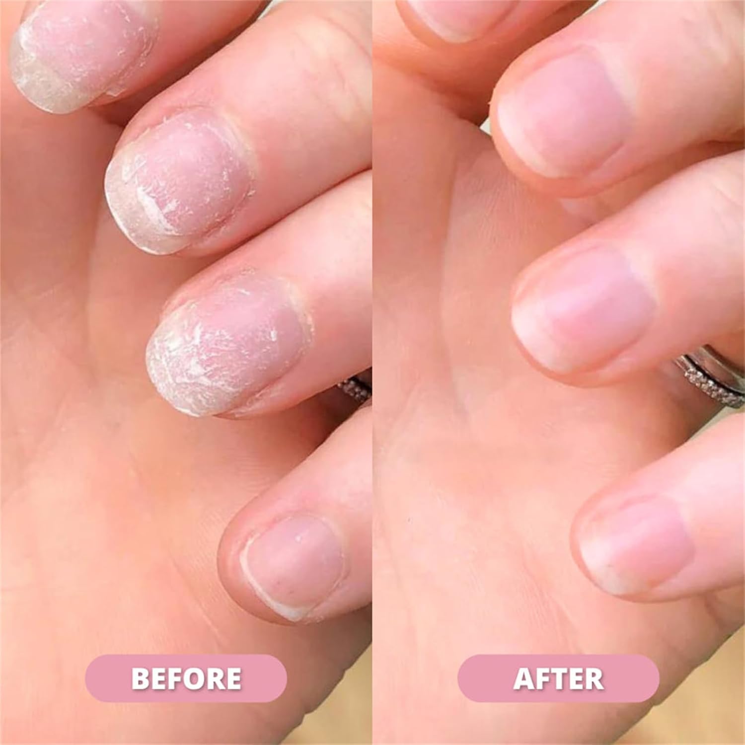 Nail Growth & Cuticle Oil Pen, Moisturizing & Strengthening Nail Serum