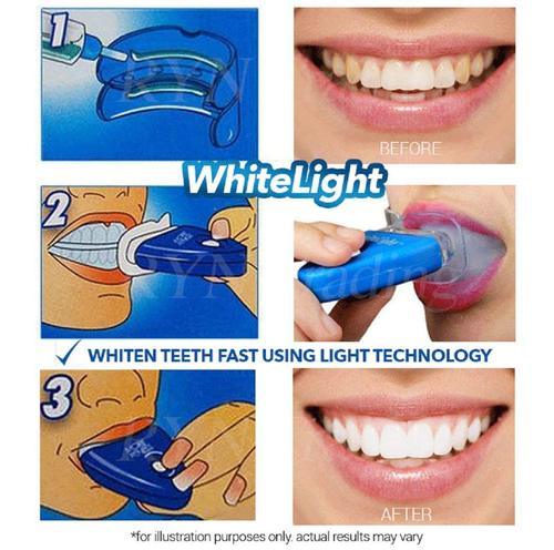 Teeth Whitening Kit LED Light Dental Whitening Set