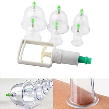 10 Piece Hijama Cupping Therapy Set With Manual Vacuum Pump