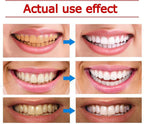 Yayashi SP-4 Ultra Whitening Toothpaste – 150ml Probiotic Stain Remover for Bright,