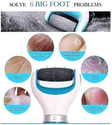 Electronic Dry Foot File Dead Skin Remover for Smooth Feet