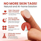DermaSmooth Herbal Hydrocolloid Skin Tag Removal Patches