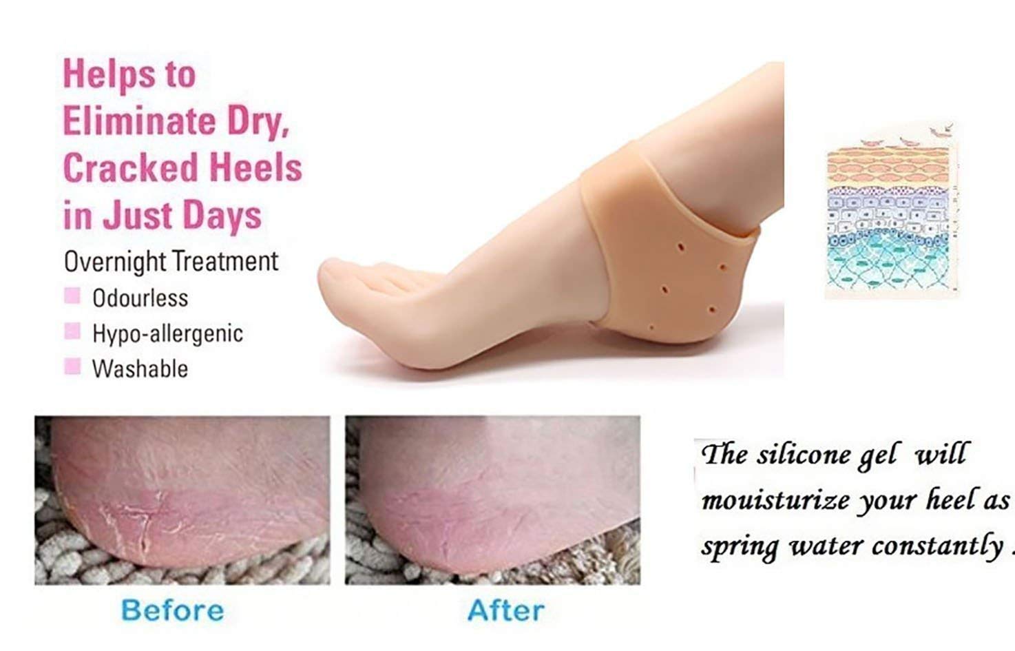 Orthopedic Silicone Heel Protectors, Medical Grade Cushioned Heel Pads (Pair)