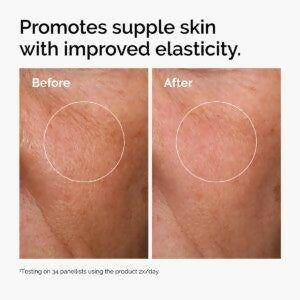 The Ordinary Hyaluronic Acid 2% + B5 Is A Hydration Support Formula Designed To Provide Surface Hydration And Support Skin Comfort. This Formula Contains 2% Hyaluronic Acid And Vitamin B5. It Is Made With Ultra Pure Vegan Hyaluronic Acid And Comes In A 30