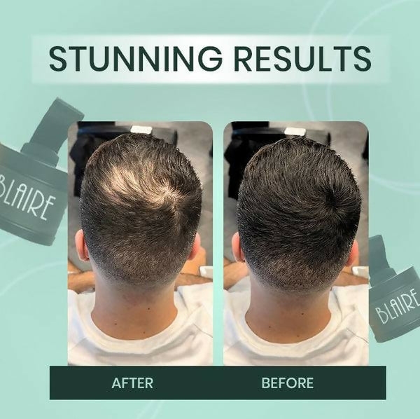 Instant Root & Thinning Hair Concealer