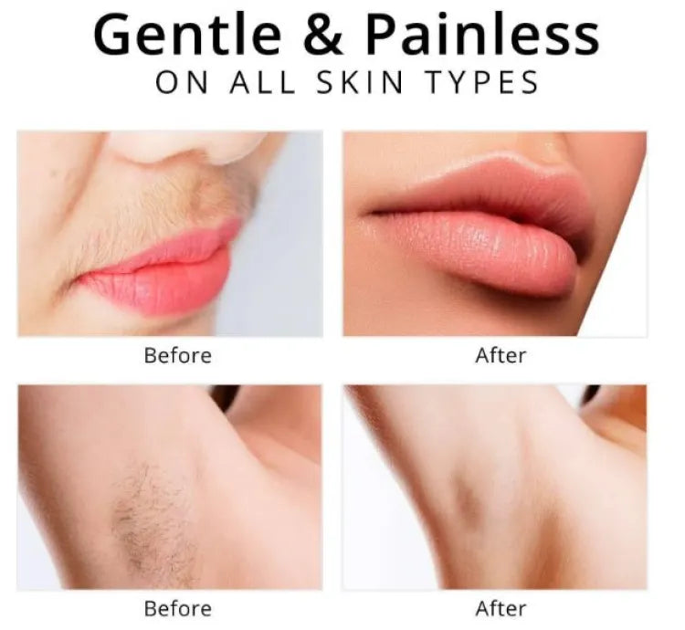 Facial Hair Remover, USB Rechargeable, for Women