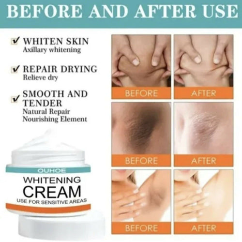 Whitening Cream for Private Parts