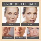 Botox Cream Advanced Skincare Formula For Reducing Wrinkles And Restoring Youthful Glow - 20g
