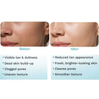 Pilgrim Peeling Solution | Weekend Facial Peel for Deep Cleansing & Exfoliation | Radiant & Even-Toned Skin | For Men & Women | 30ml