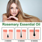 Rose Essential Oil for Hair Growth Nutrient Solution Hair Growth Essence Liquid Fast Natural Hair Loss Treatment Hair Care, 100% Pure Natural 30ml