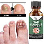 Fast Nail Fungus Treatment Serum