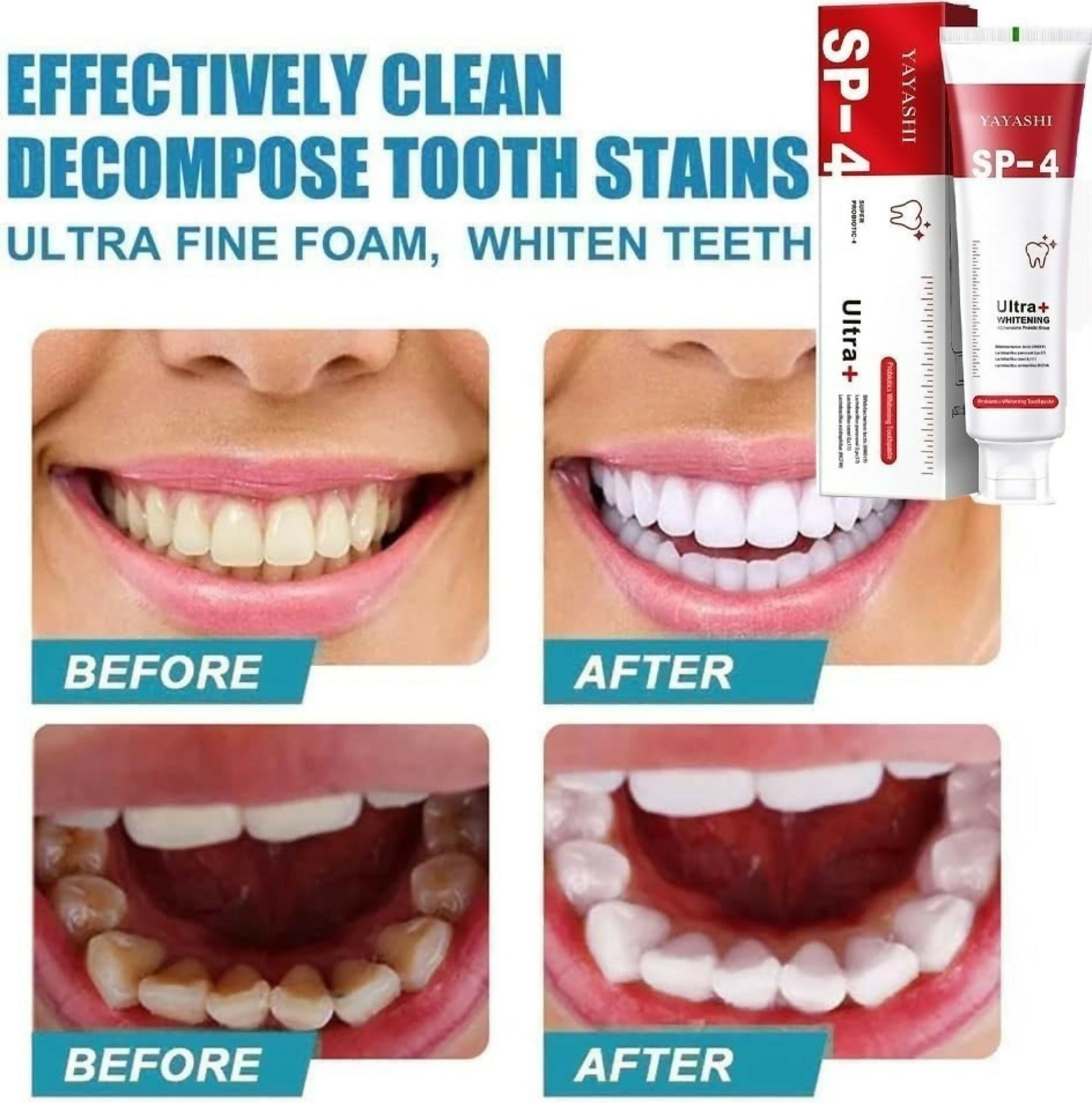 Yayashi SP-4 Ultra Whitening Toothpaste 150ml – Probiotic Stain Remover for Bright, Healthy Teeth