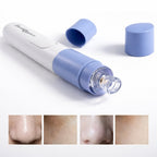 Electric Blackhead Remover Vacuum Pore Cleaner Skin Care Tool