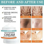 Sensitive Area Whitening Cream 30ml | Private Parts, Underarms & Inner Thighs Dark Spot Care