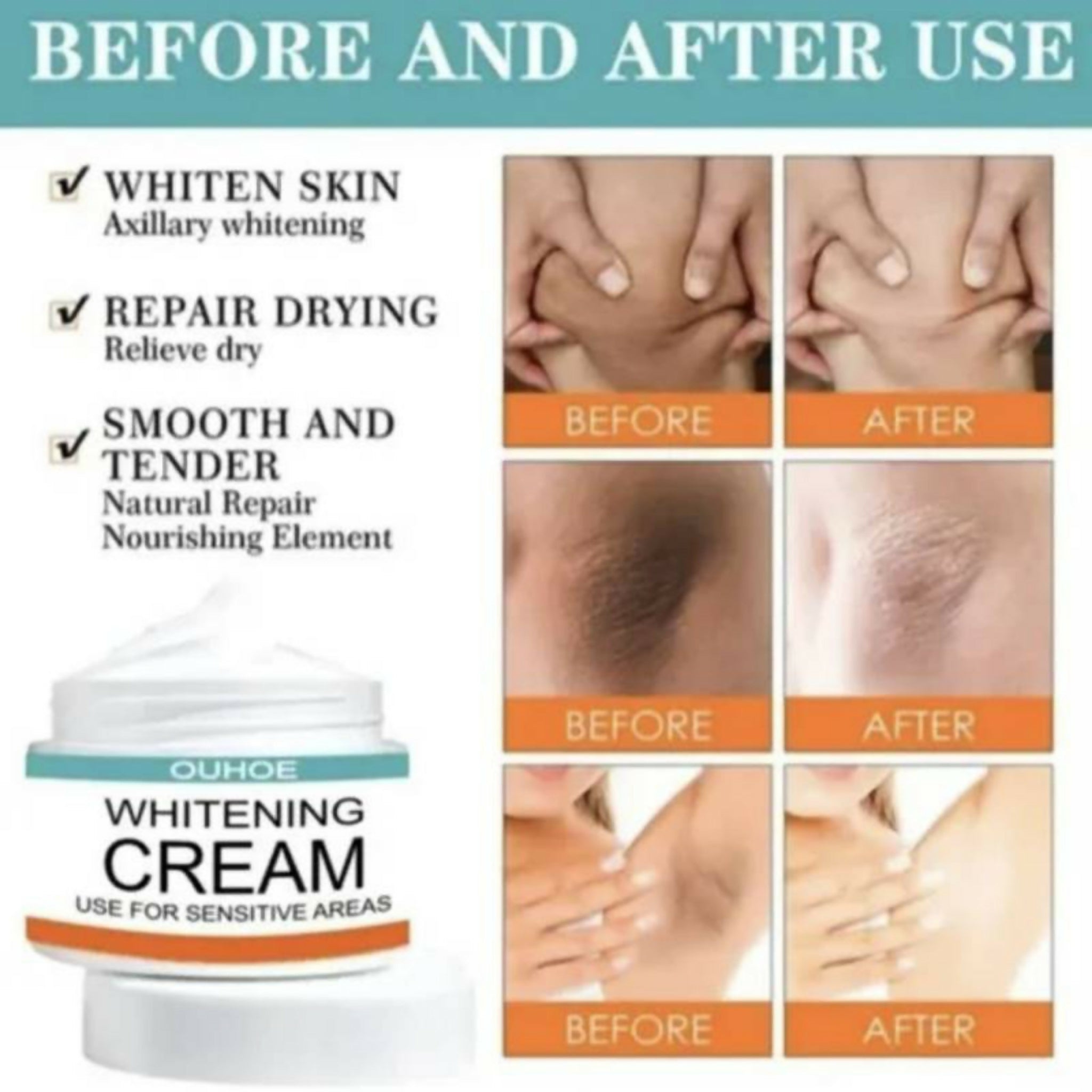 Sensitive Area Whitening Cream 30ml | Private Parts, Underarms & Inner Thighs Dark Spot Care