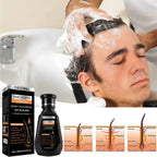 Anti Hair Fall Shampoo Biotin Caffeine Scalp Nourishing Formula