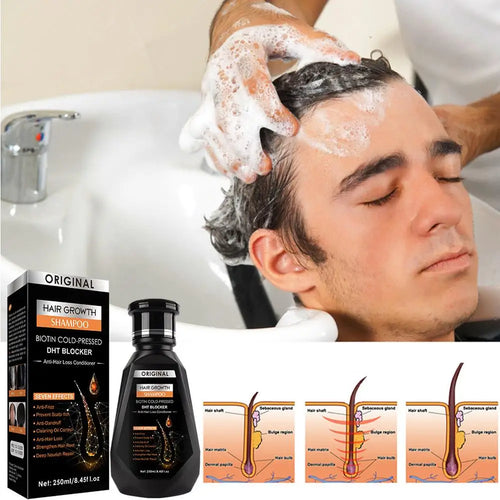 Anti Hair Fall Shampoo Biotin Caffeine Scalp Nourishing Formula