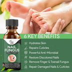 Fast Nail Fungus Treatment Serum