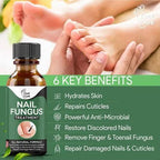 Fungal Nail Treatment, Repair Solution for Damaged and Discolored Nails