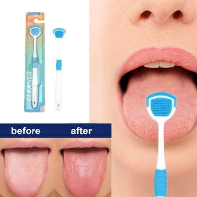 Silicone Tongue Cleaner Brush Soft Bristles Fresh Breath Oral Care Tool - 3Pcs