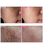 Arbutin 7% + Tranexamic Acid 4% Cream | Brightening Moisturizer for Dark Spots, Uneven Tone & Hydration | 50g