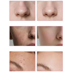 Arbutin 7% + Tranexamic Acid 4% Cream | Brightening Moisturizer for Dark Spots, Uneven Tone & Hydration | 50g
