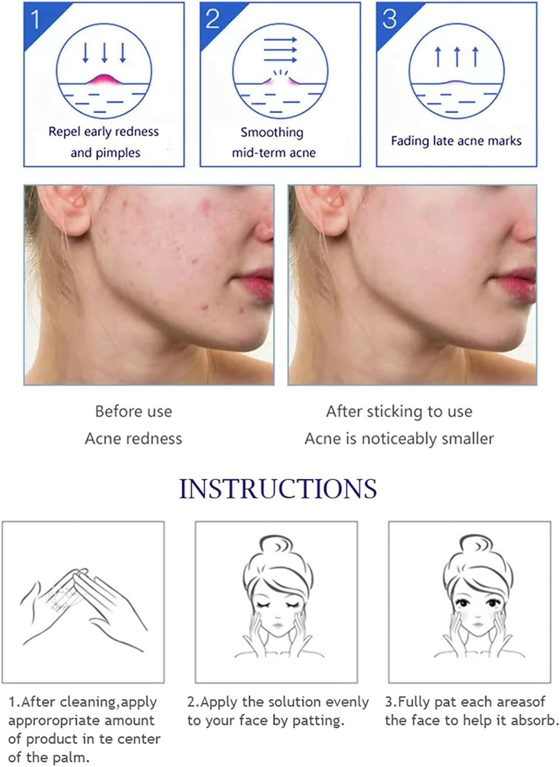 Aichun Beauty Anti - Acne Whitening Facial Serum Aloe Vera Extract Salicylic Acid Repairs Damaged Skin | 30ml