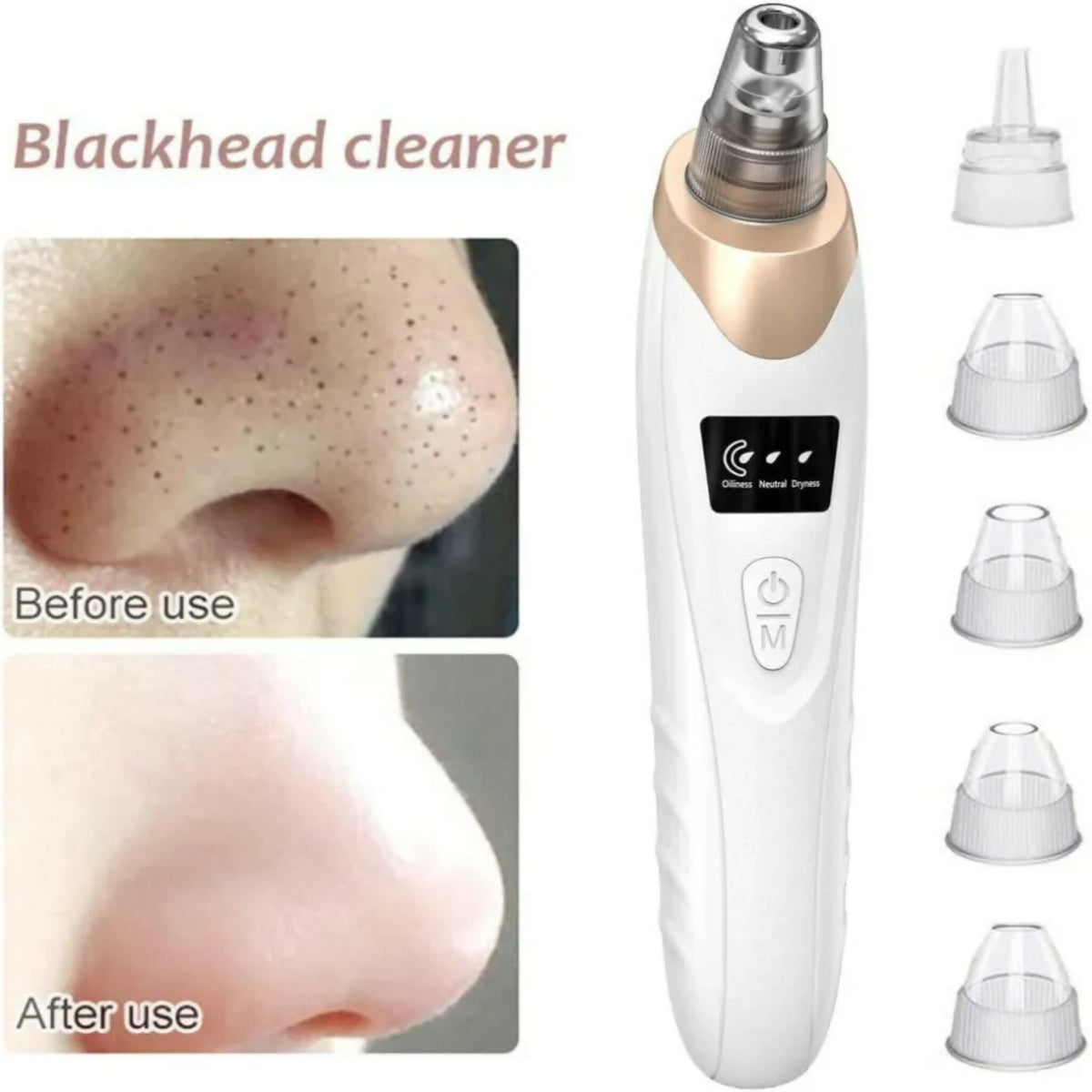 5 in 1 Blackhead Remover Machine Rechargeable Pore Cleaner | Facial Pore Cleansing & Skincare Device
