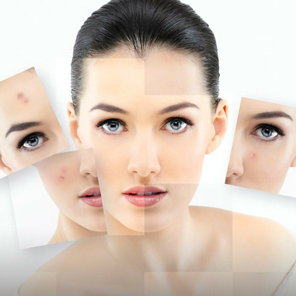 BIOAQUA Acne Removal & Rejuvenation Moisturizing Mask