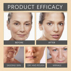 Botox Bee Venom Whitening & Moisturizing Cream – Anti-Aging, Brightening & Skin Firming Facial Care (20g)