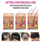 Anti-Grey Hair Serum, for Grey Hair Scalp Nourishing Oil - 30Ml