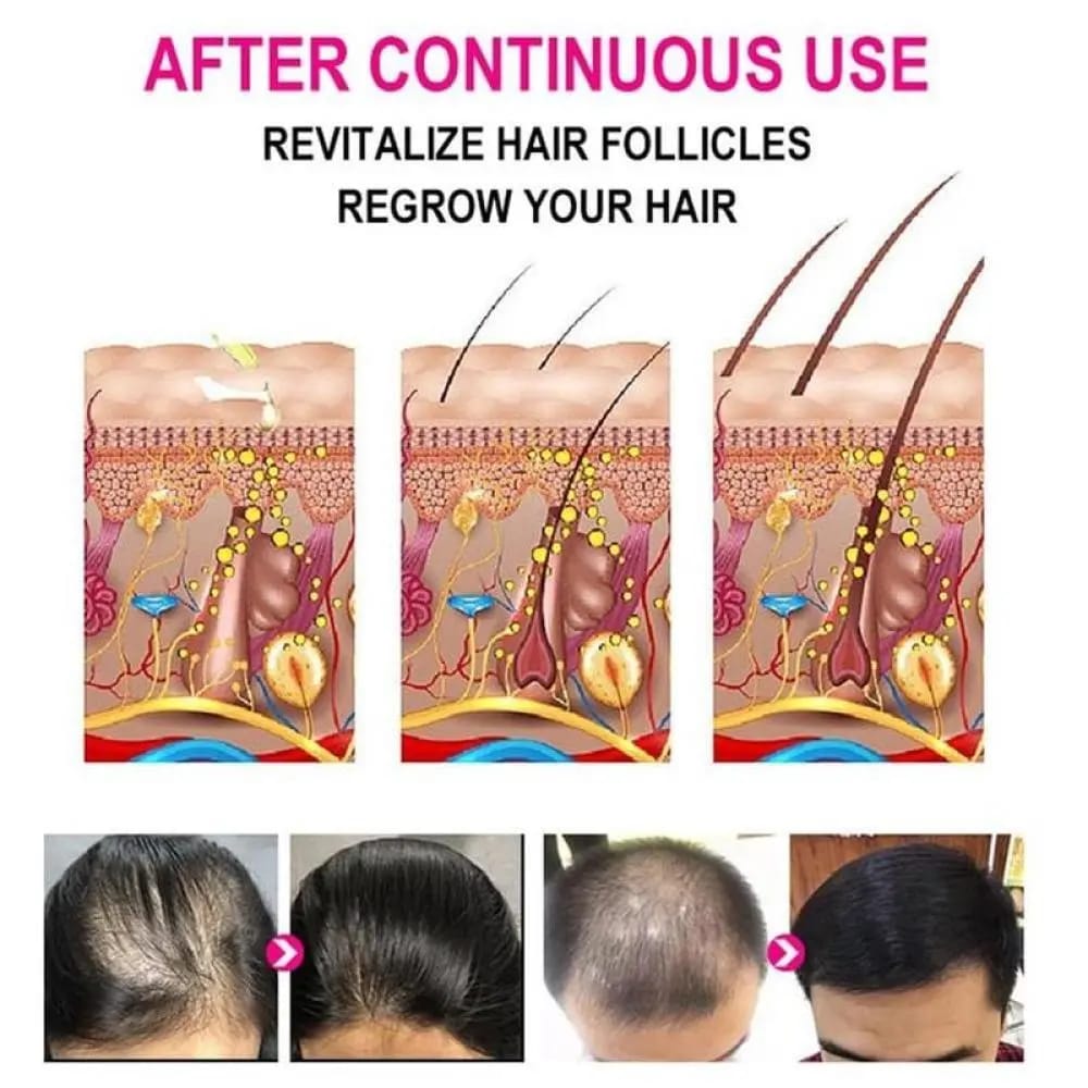 Anti-Grey Hair Serum, for Grey Hair Scalp Nourishing Oil - 30Ml