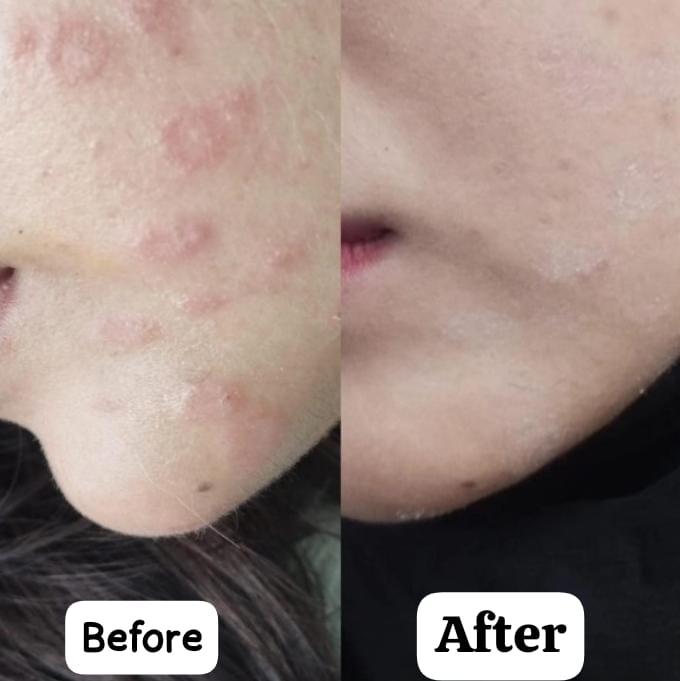 Hydraluxe Skin Care Serum,  Nourishing Face Serum - 30ml