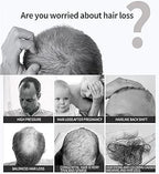 Hair Nourishing Oil Spray, for Hair Care and Scalp Support -  30ml