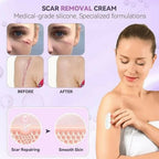 TIMILK Scarvanisher Scar Gel 30g | Advanced Scar & Stretch Marks Removal Cream | Fast-Absorbing Skin Repair Gel