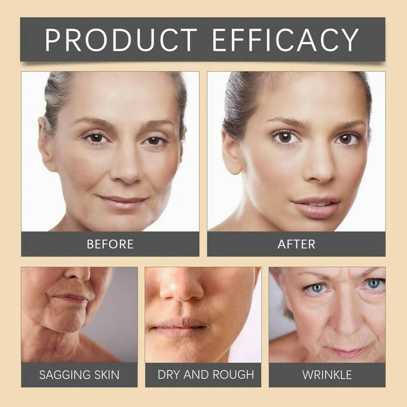 Botox Bee Venom Whitening & Moisturizing Cream – Anti-Aging, Brightening & Skin Firming Facial Care (20g)