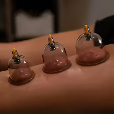 10 Piece Hijama Cupping Therapy Set With Manual Vacuum Pump