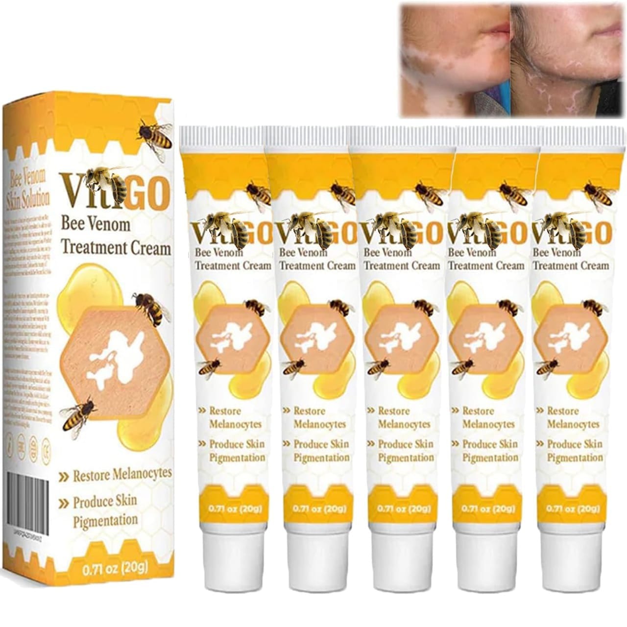 Fivfivgo™ VitiGO Bee Venom Correcting Cream 20g – Skin Tone Support