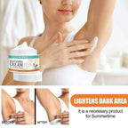Sensitive Area Whitening Cream 30ml | Private Parts, Underarms & Inner Thighs Dark Spot Care
