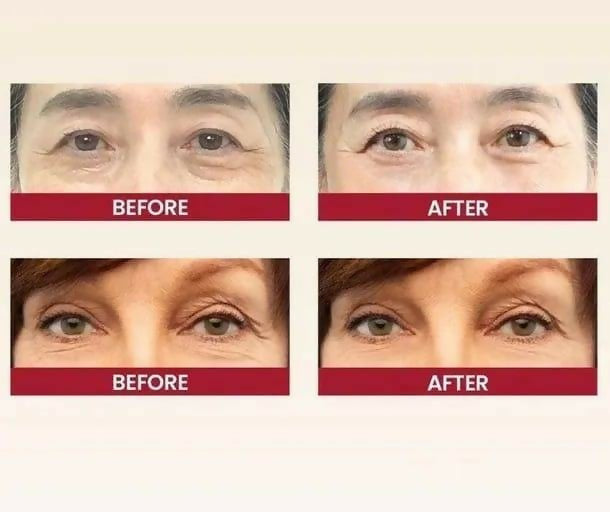 K-SECRET SEOUL 1988 Eye Cream: Retinal Liposome 2% + Fermented Black Bean – Advanced Anti-Aging & Brightening Formula – 30ml