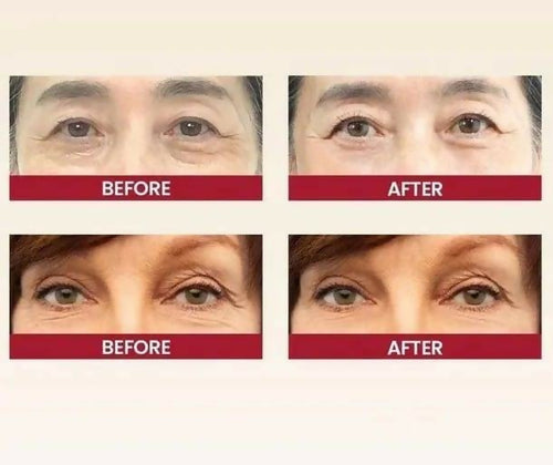 K-SECRET SEOUL 1988 Eye Cream: Retinal Liposome 2% + Fermented Black Bean – Advanced Anti-Aging & Brightening Formula – 30ml