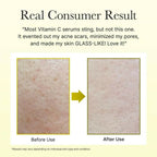 Arencia Vitamin C Booster shot | Brightening & Skin Radiance serum (30ML)