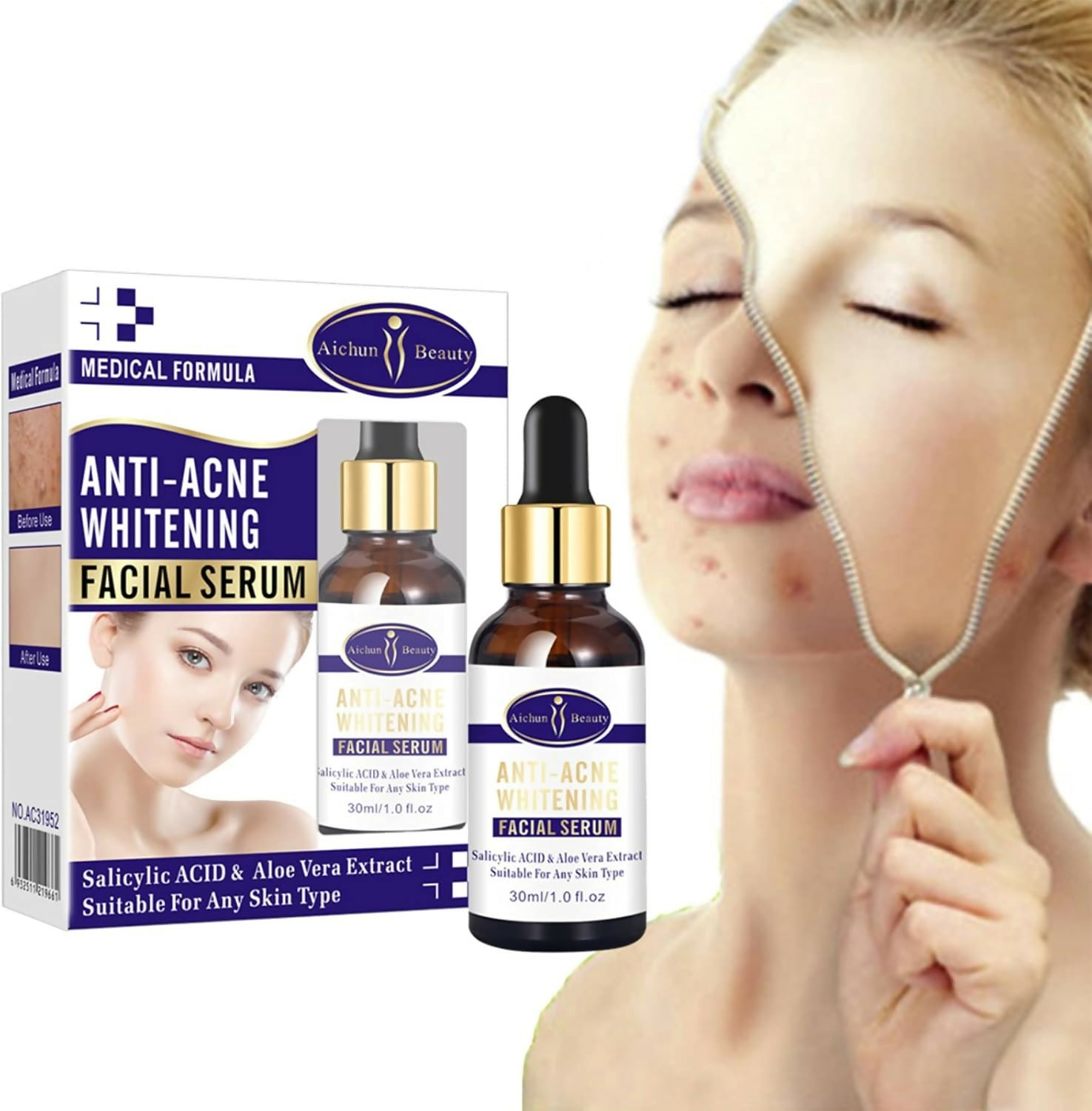 Aichun Beauty Anti - Acne Whitening Facial Serum Aloe Vera Extract Salicylic Acid Repairs Damaged Skin | 30ml