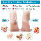 Silicone Heel Pads Anti Crack Heel Protector Heel Protectors Set Silicone Half Heel Anti Crack Covers Silicone Moisturizing Gel Heel Anti Crack Socks