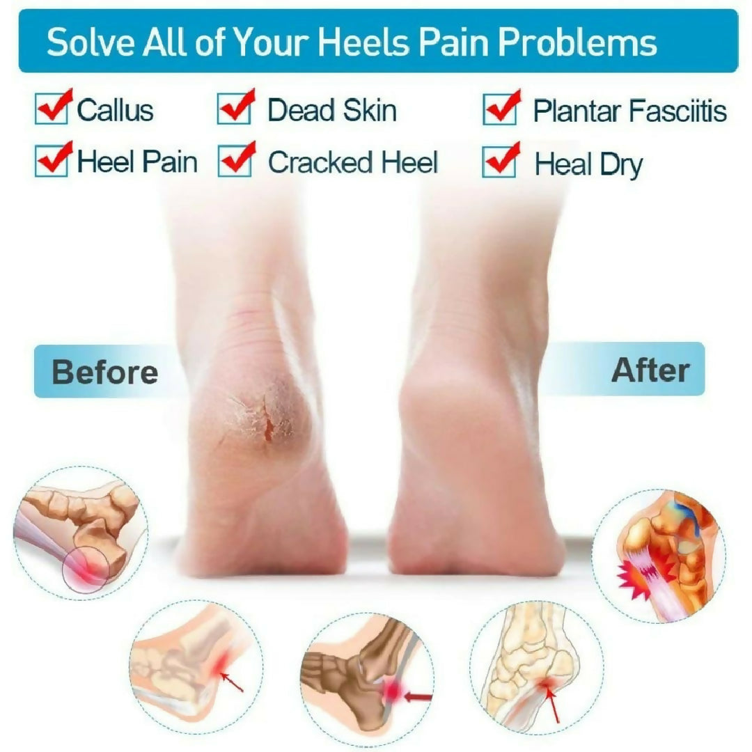 Silicone Heel Pads Anti Crack Heel Protector Heel Protectors Set Silicone Half Heel Anti Crack Covers Silicone Moisturizing Gel Heel Anti Crack Socks